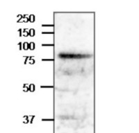 VSR1 | Vacuolar-sorting receptor 1 in the group Antibodies Plant/Algal / Membrane Transport System / Endomembrane system at Agrisera AB (Antibodies for research) (AS20 4407)